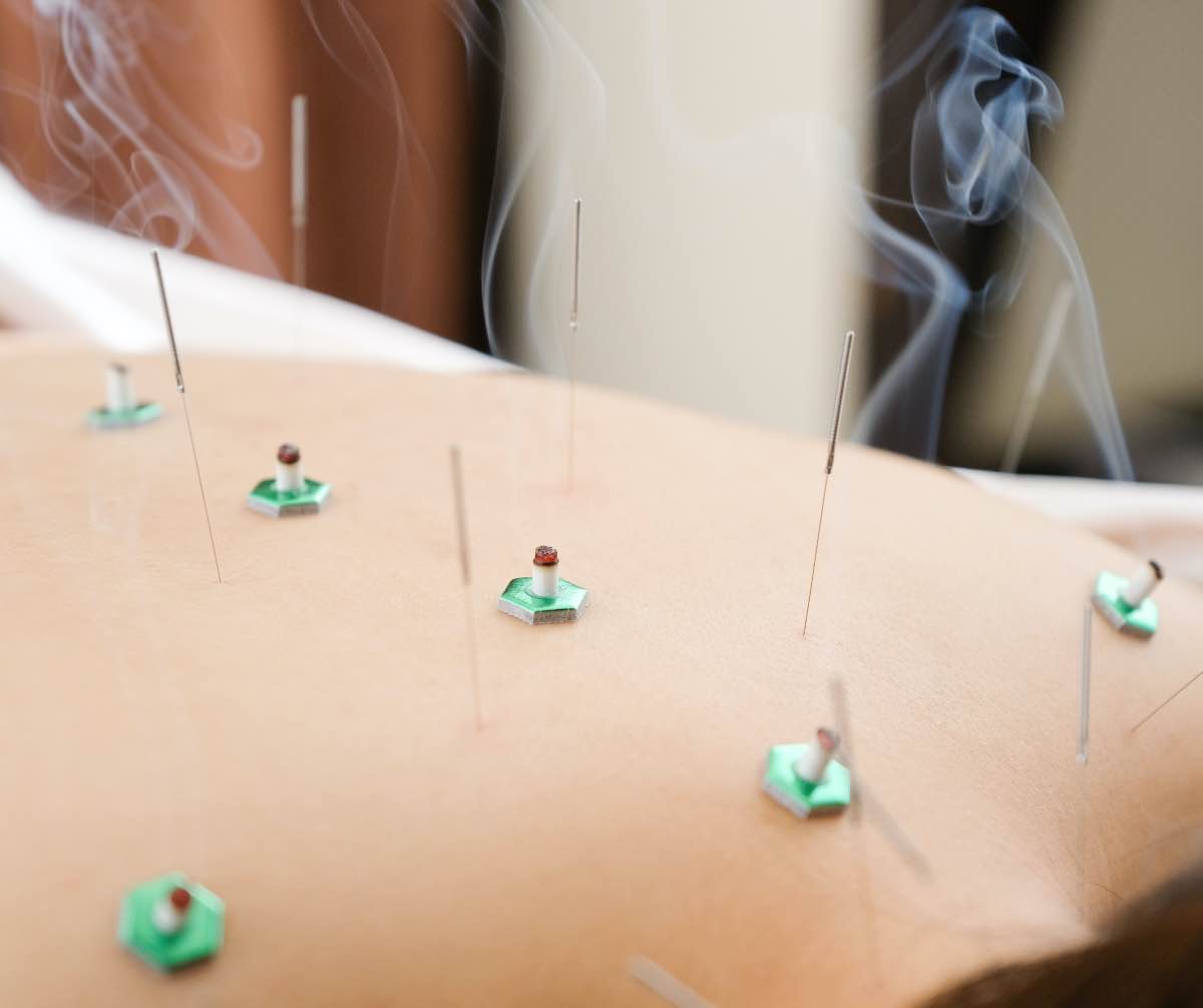 1979年開院地域に根ざした鍼灸整骨院です。